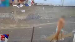7-anyos na babae, sugatan nang sakmalin sa mukha ng nakawalang aso sa Laguna