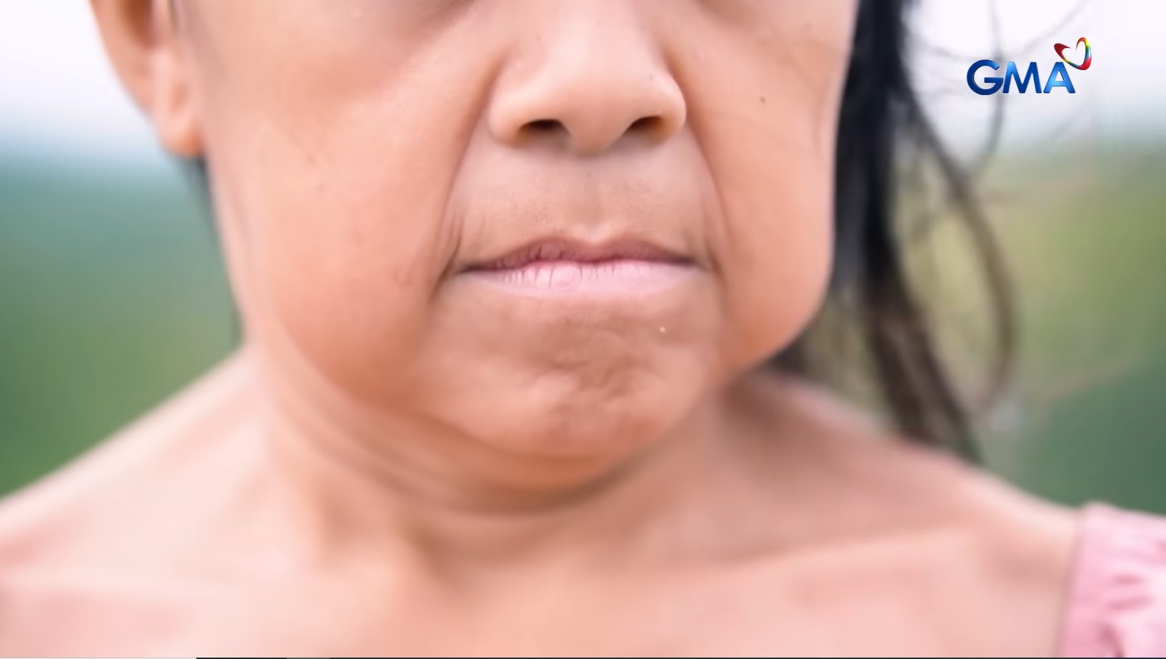 10-anyos na babae, ano nga ba ang kondisyon at tila naging matanda na ang hitsura? thumbnail