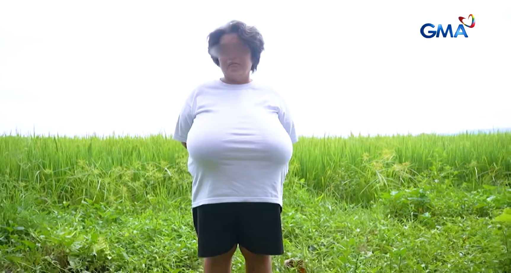 Babae sa South Cotabato, ano nga ba ang sanhi ng paglaki ng dibdib?