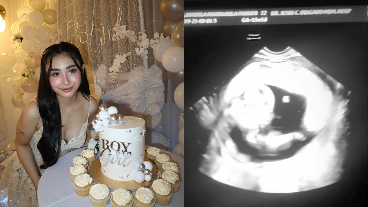 Bea Borres shares sonogram of her baby