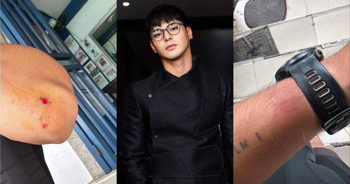 Kristoffer Martin gets involved in motorcycle accident