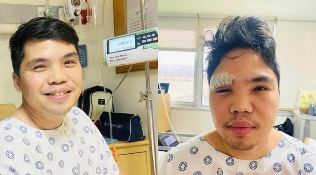 Left: One day before surgery; Right: One day post-surgery