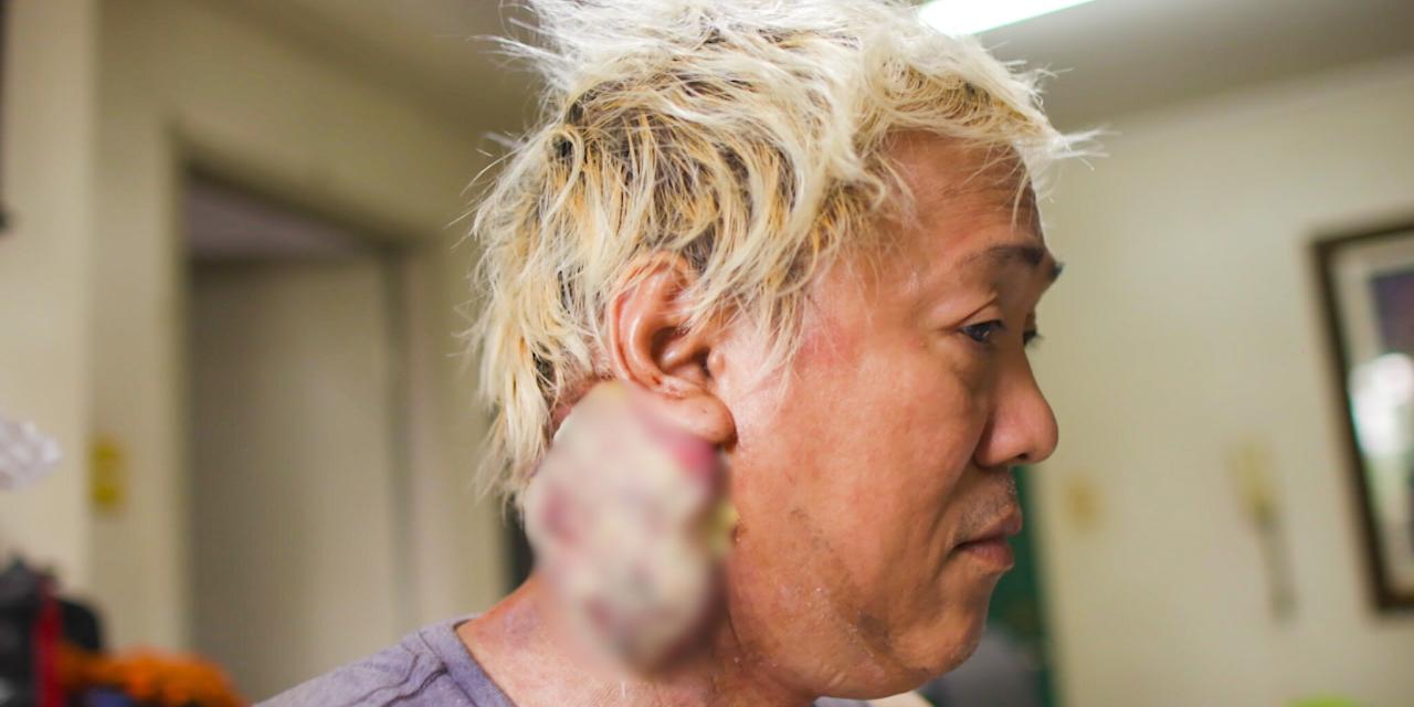 Ate Gay diagnosed with stage 4 cancer: 'Wala raw lunas' | GMA News Online
