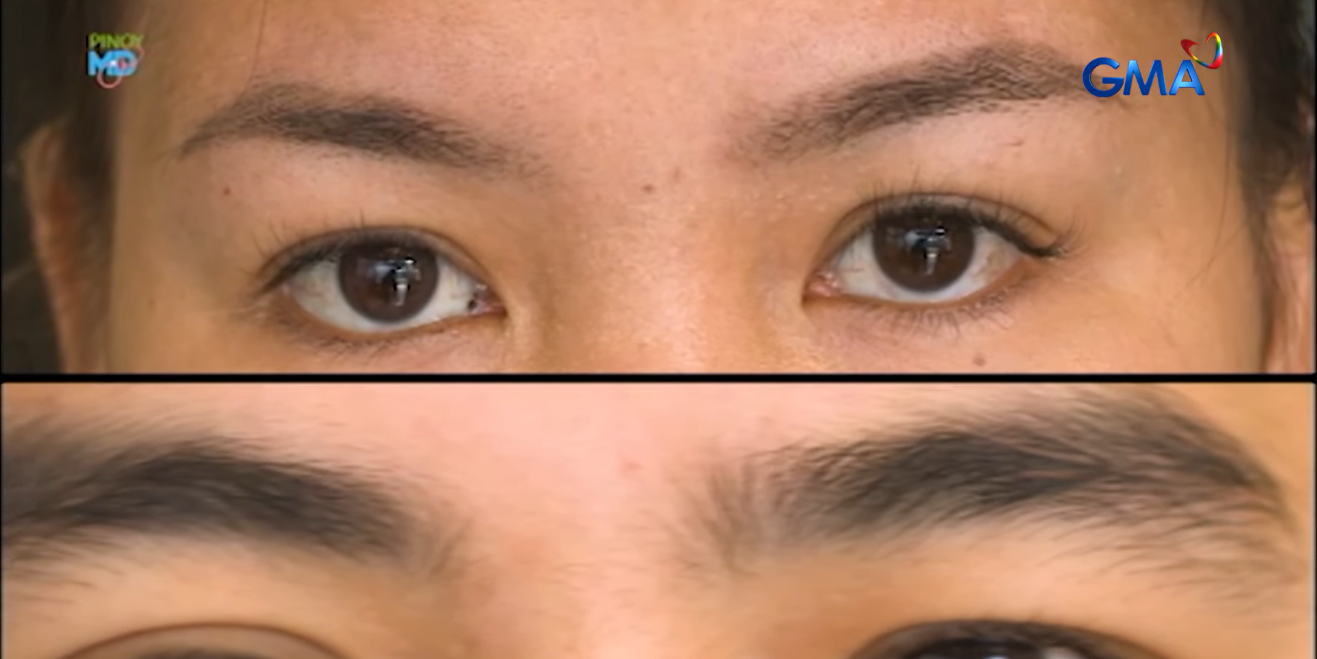 Here's how to address thinning eyebrows, according to a dermatologist