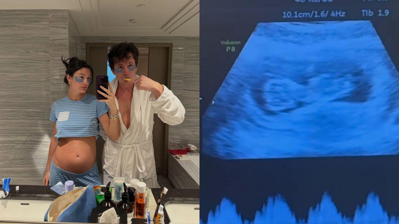 Charlie Puth and wife share pics of baby bump, sonogram of their baby