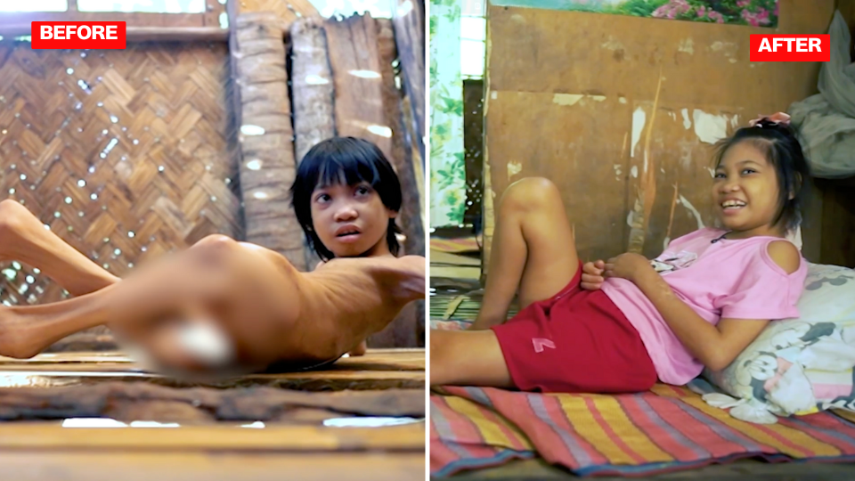 'KMJS' gives update on 'Aurora,' the 17yo girl suffering from compulsions to bite and chew, other mental health conditions