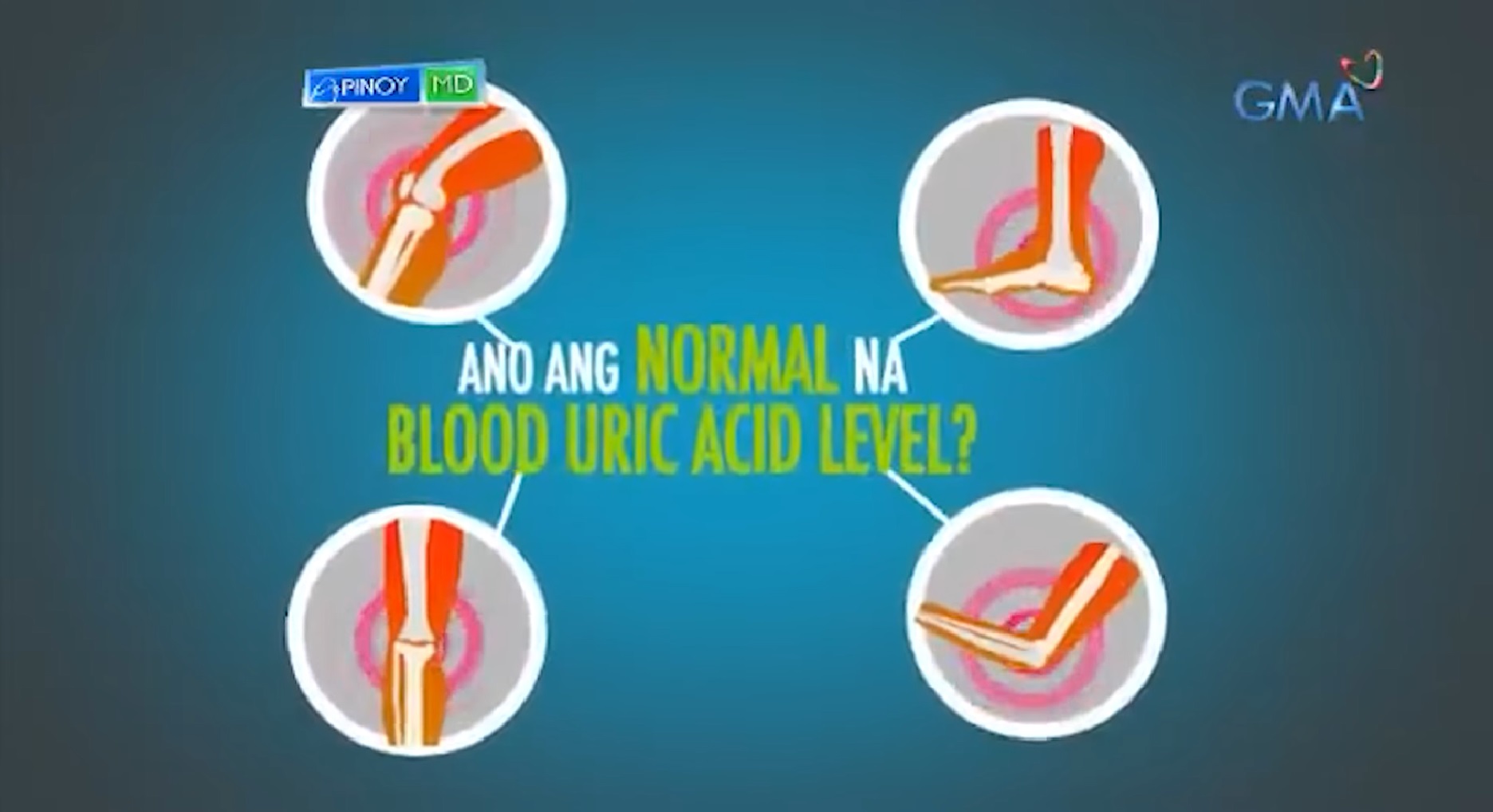 Ano nga ba ang uric acid sa katawan at paano ito maiiwasan na tumaas?