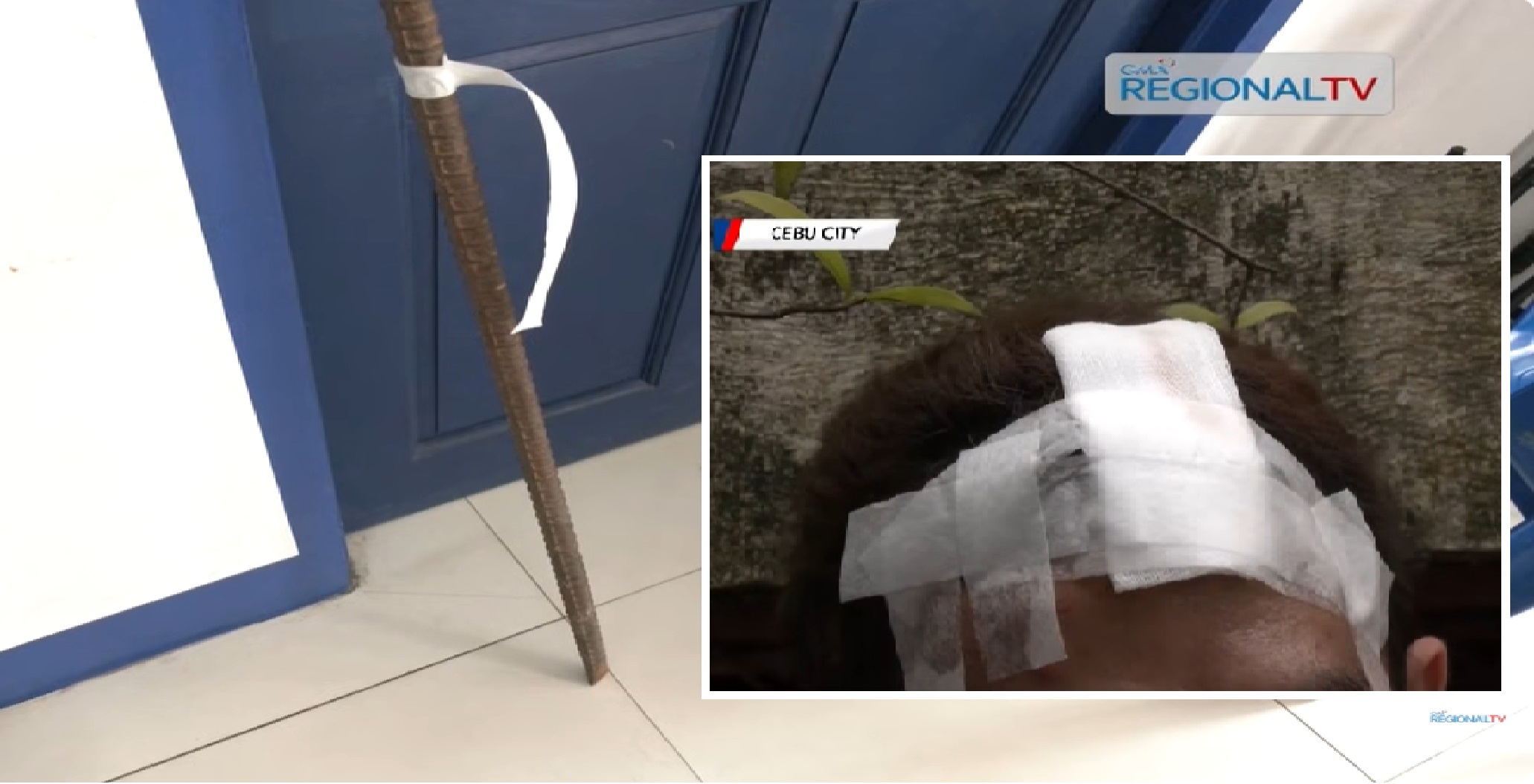 Lalaki na 'di umano nagpahiram ng bagong cellphone, hinataw ng bareta sa ulo