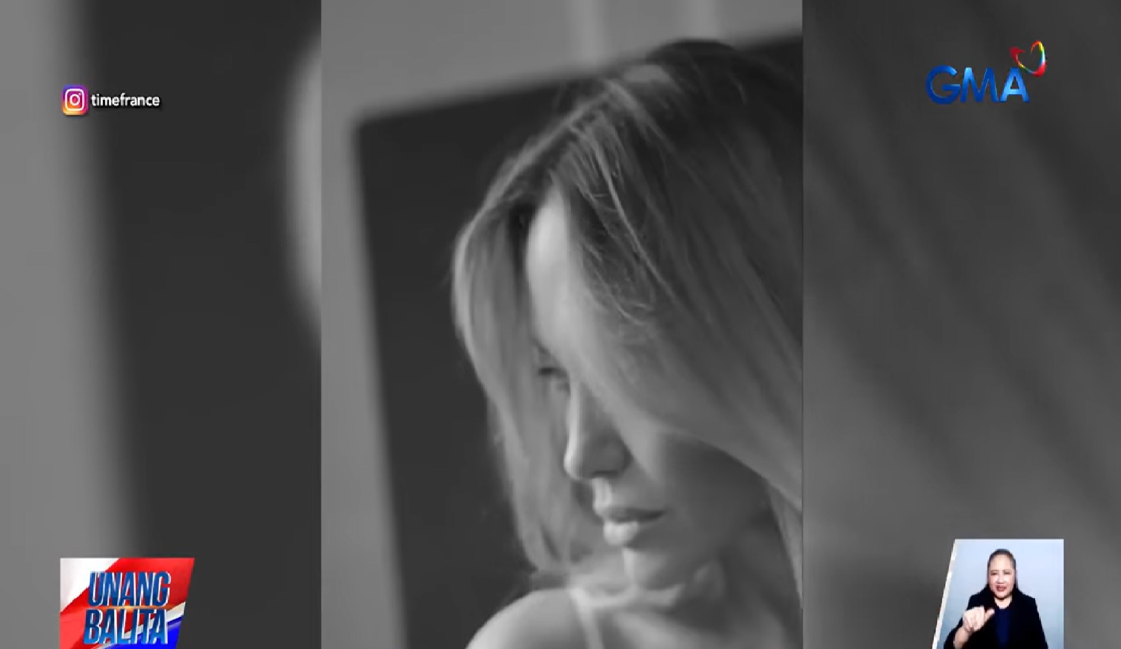 Angelina Jolie, ipinakita ang pilat mula sa kaniyang operasyon sa dibdib na mastectomy noong 2013