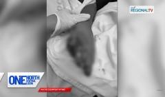 11-anyos na lalaki, nawasak ang kamay matapos masabugan ng pinulot na paputok