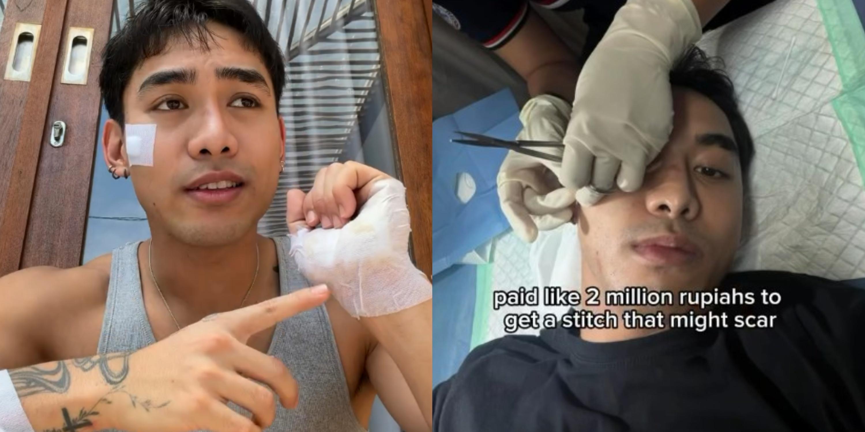 Joshua Decena figures in motorcycle accident in Bali 