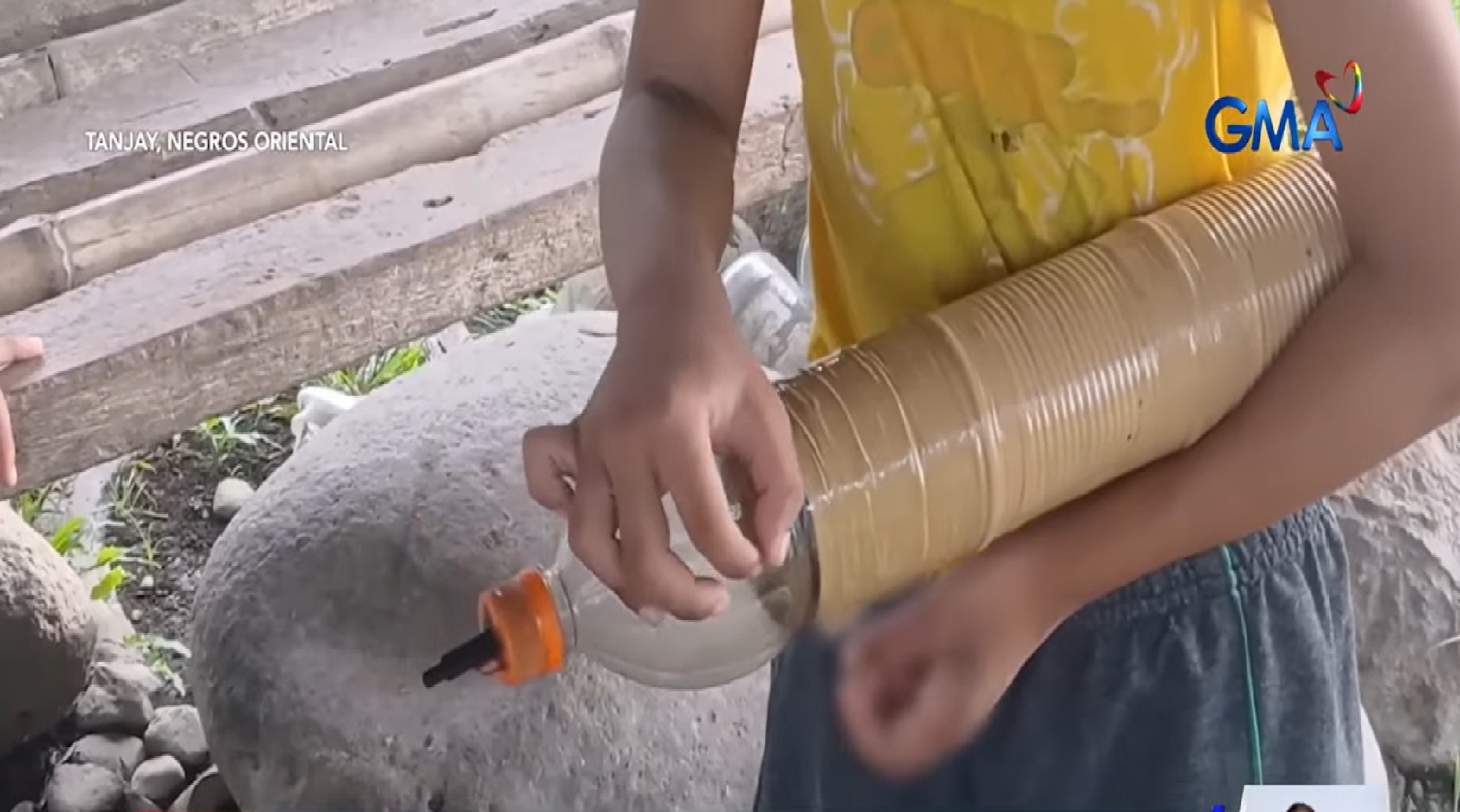 6-anyos na lalaki, sugatan ang kamay nang subukang paputukin ang isang boga