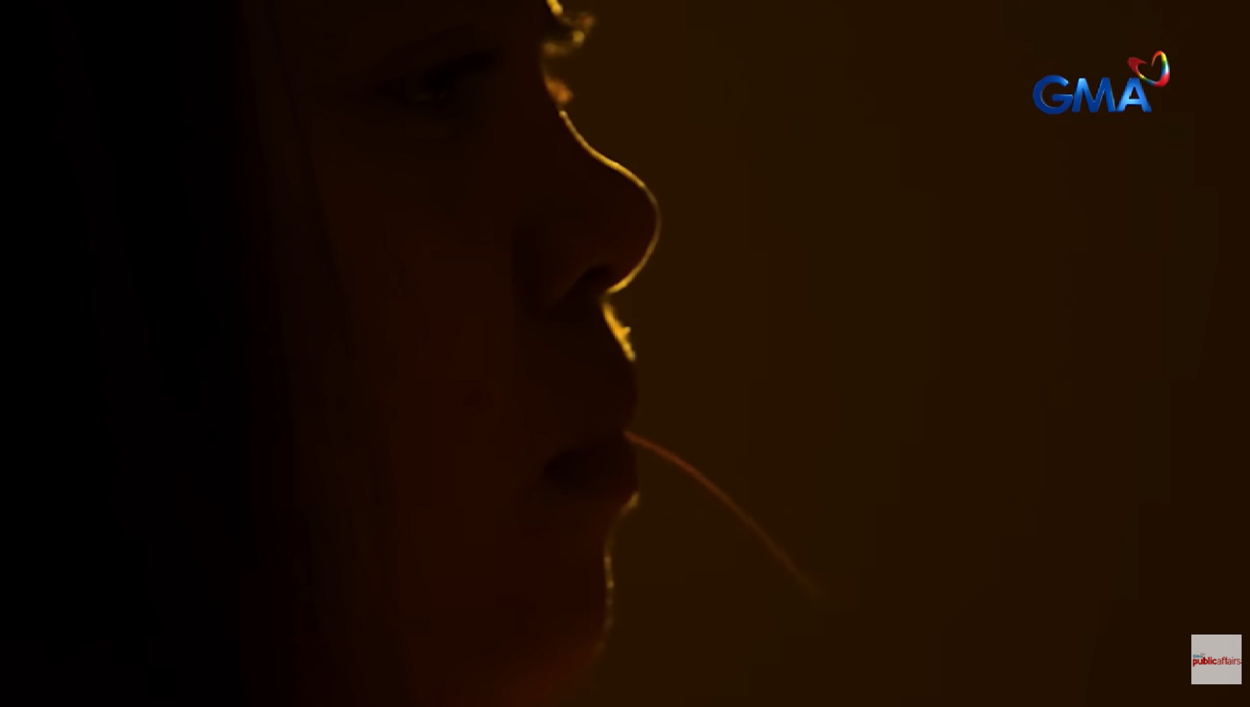 Dalagita, inoperahan sa tiyan dahil sa nagkumpol-kumpol na buhok na kaniyang kinain