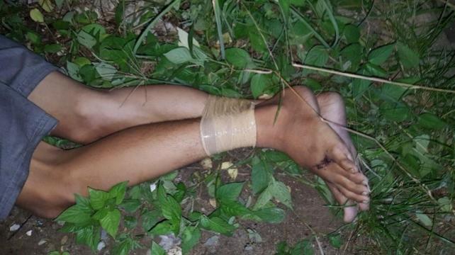 The ankles of Ephraim Escudero are bound by duct tape as his body is recovered amid the Duterte administration's drug war. His face and wrists were wrapped in duct tape as well. The photo was provided by his sister, Sheerah, who watched from the International Criminal Court (ICC) gallery the second day of the confirmation of charges hearing of former President Rodrigo Duterte on his crimes against humanity case. Courtesy: Sheerah Escudero