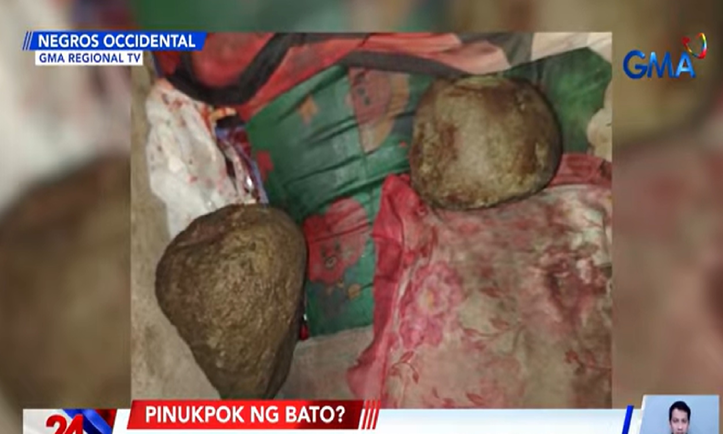 3 batang magkakapatid, pinagpapalo gamit ang bato; 1, nasawi