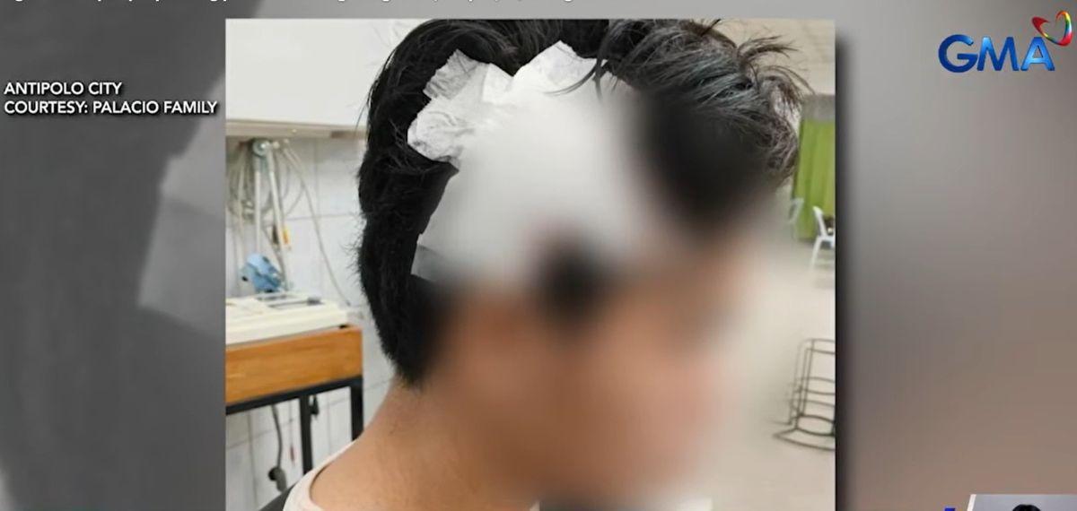 17-anyos na binatilyo, sugatan matapos pukpukin ng palakol