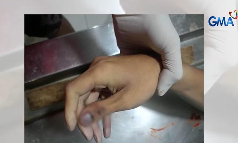 19-year-old teenager dies due to suspected hazing in Cavite