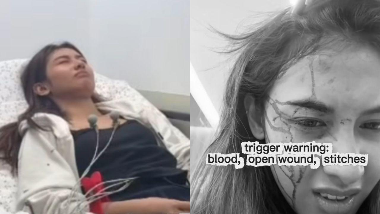 Thea Astley reveals suffering head injury before solo show