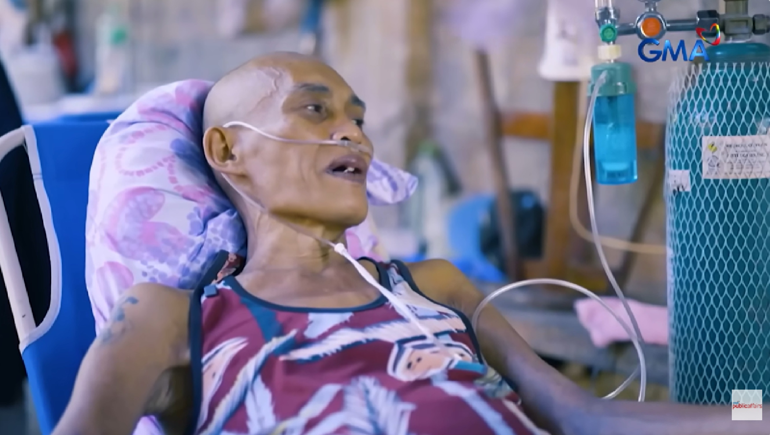 Mga pasyenteng nagdurusa dahil sa kawalan ng maayos na pampublikong ospital sa kanilang lalawigan