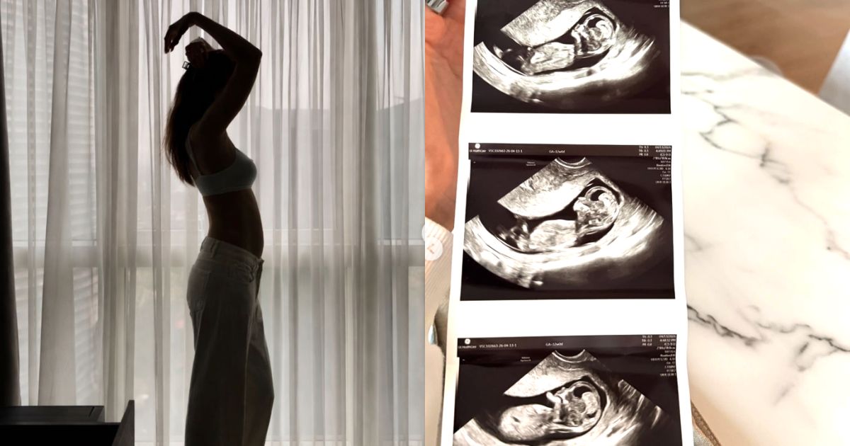 Celeste Cortesi announces pregnancy