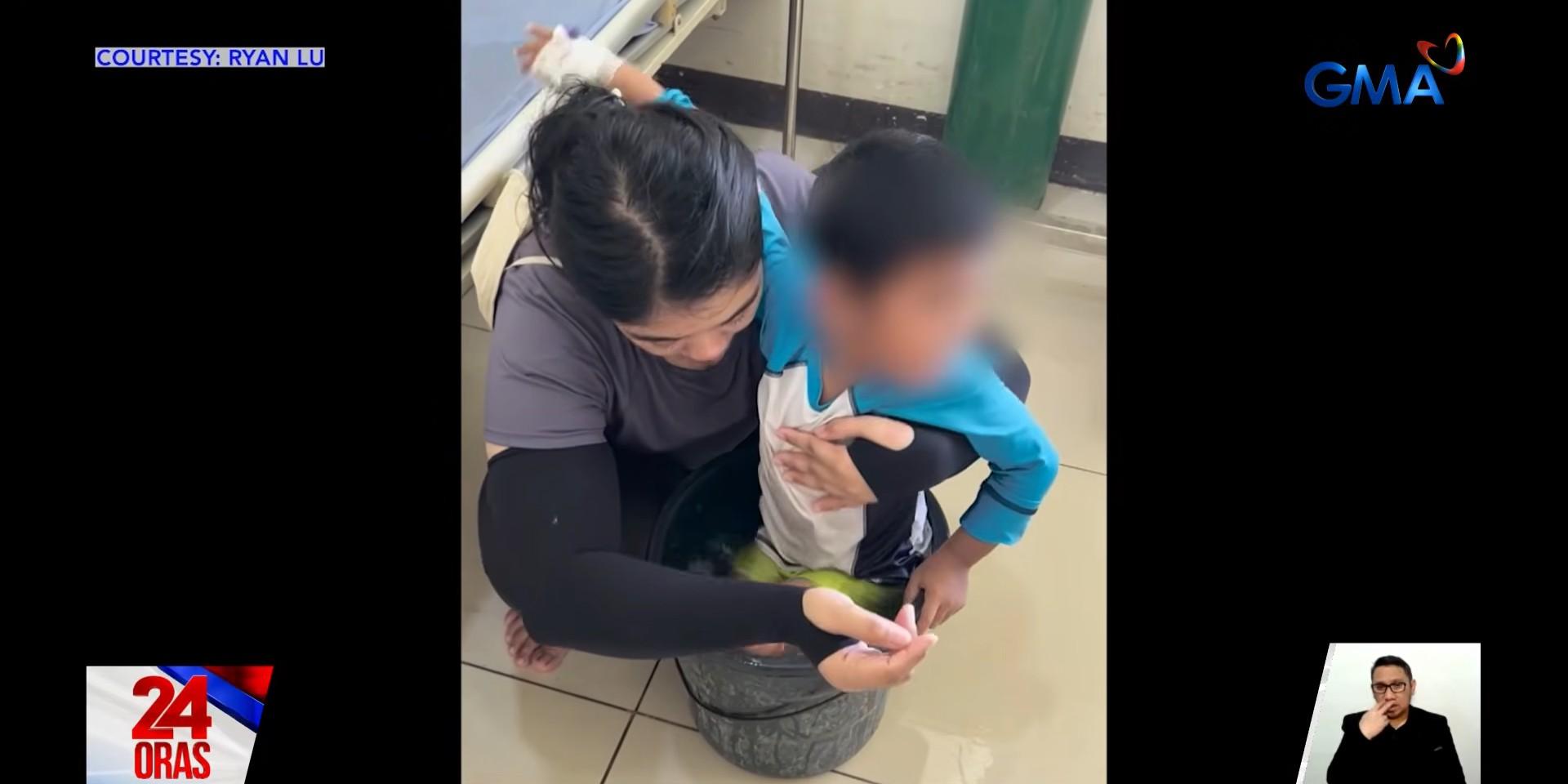 4-year-old recovering from box jellyfish sting in Palawan | GMA News Online