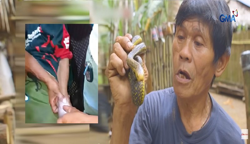 Lalaking ‘di umano tinatablan ng kamandag ng ahas, makaligtas kaya matapos matuklaw ng King Cobra?