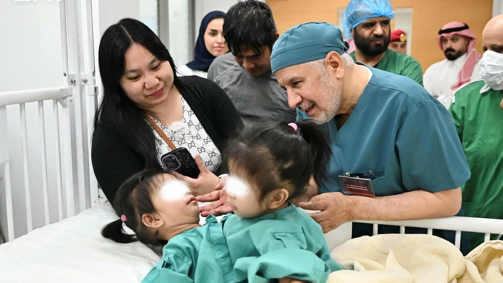 Filipino conjoined twins undergoing separation surgery in Saudi Arabia