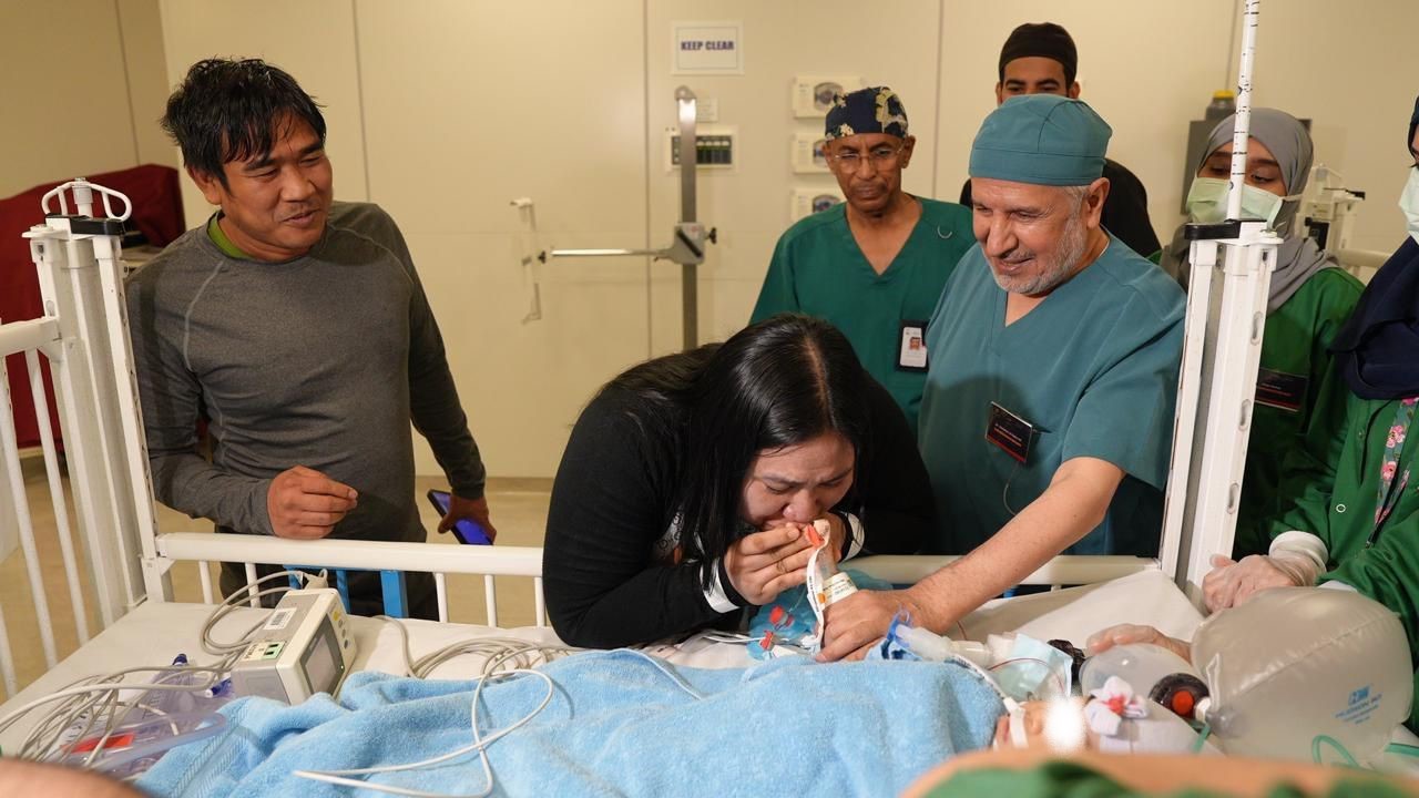 Fourth Filipino conjoined twins successfully separated in Saudi Arabia
