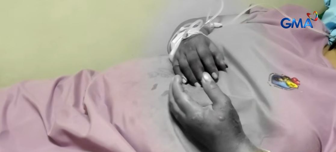 8-month-old baby, 2 others suffer burns in lightning strike in Masbate City
