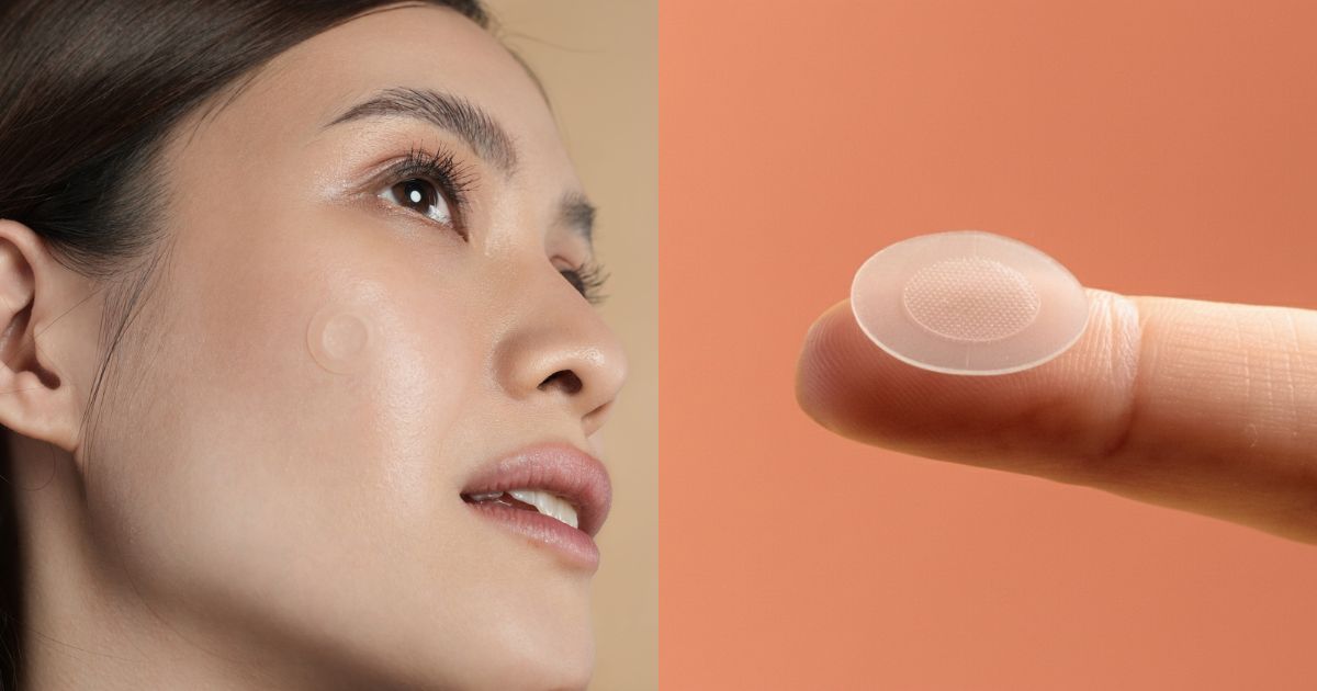 Pimple patches: What they can and can't do for acne, according to experts