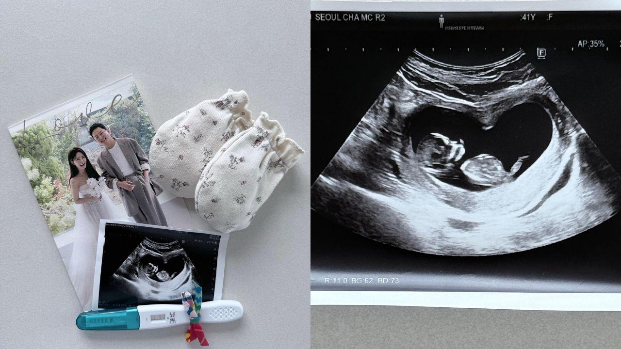 Kim Ji Min, Kim Joon Ho announce pregnancy via IVF