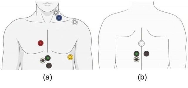Adhesive sensor stickers placed on a patient's back collected the physiological measurements used in the study: (a) Sensor placement and (b) Sensor stickers. Photo: Chang et al., 2026.