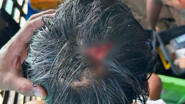 A photo posted by the AFP shows the head injury suffered by the Navy man from the attack. Photo: Armed Forces of the Philippines
