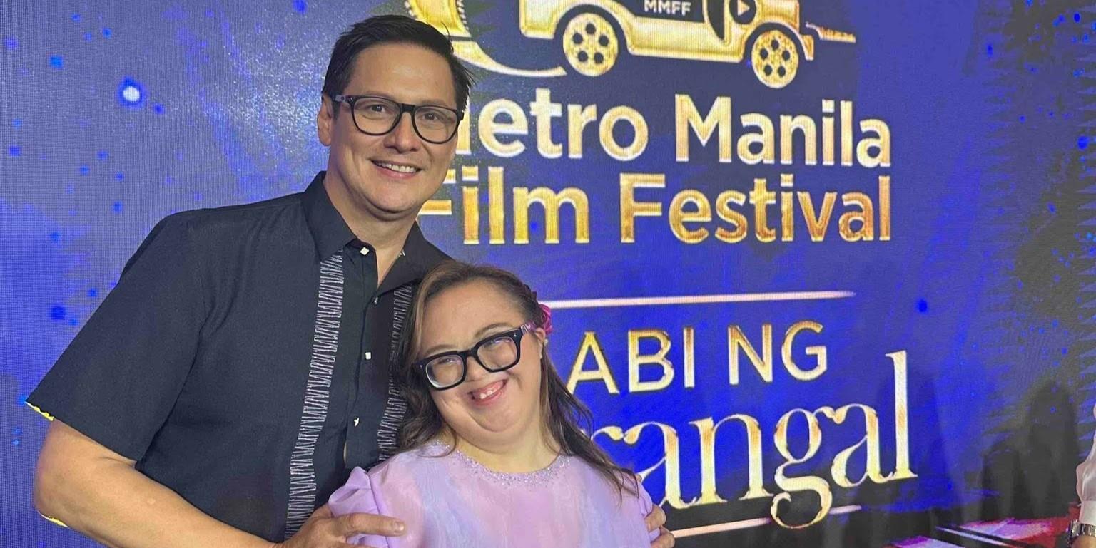 Matthew Mendoza proud of daughter Bea, shares message for parents of children with Down syndrome