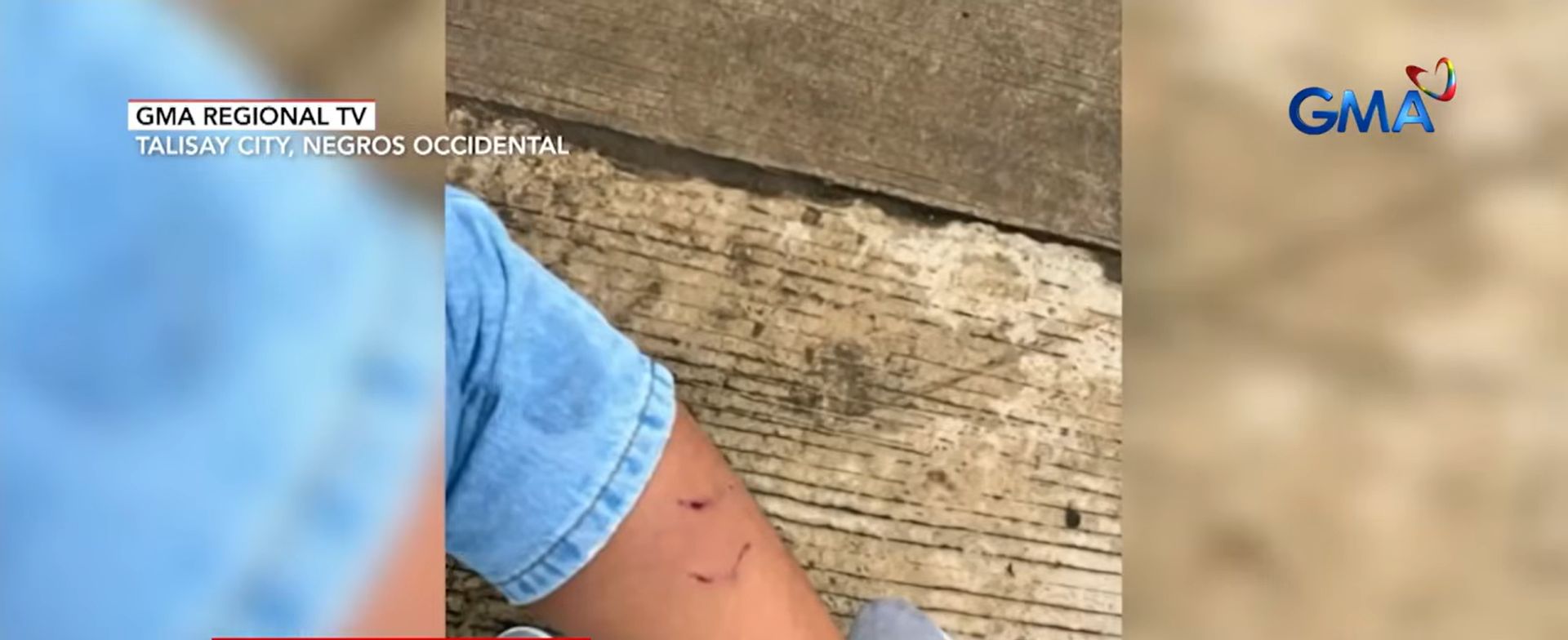 Asong gala, umatake sa Negros Occidental; 4 residente sugatan, 3 kambing patay
