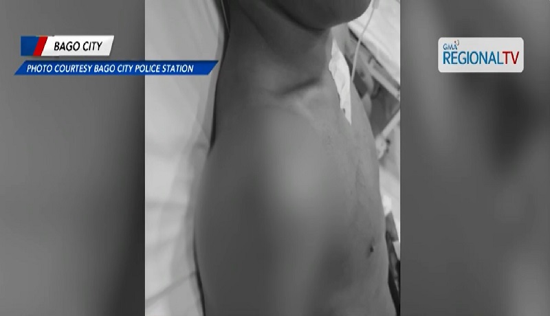 16-anyos na lalaki, sinaksak ng isa ring menor de edad sa Bago City