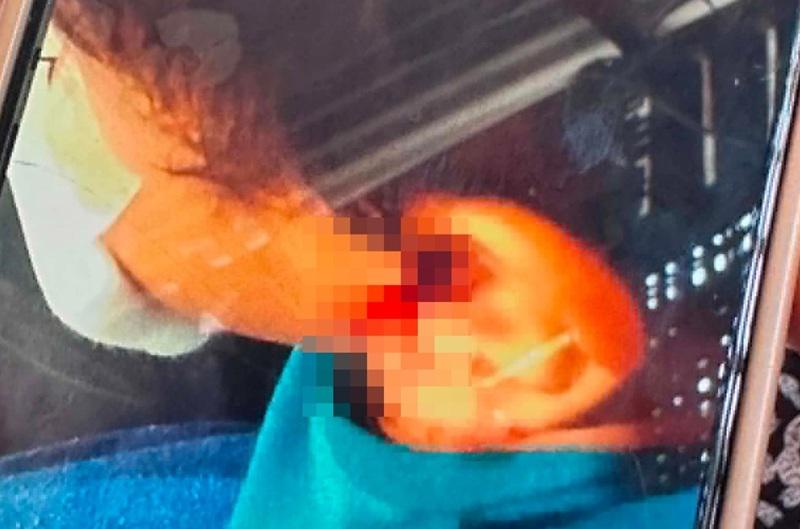 Boy in GenSan dies after getting bitten by rabid dog