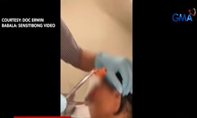 Ipis nakuha sa loob ng tainga ng ginang