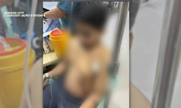 Taxi driver, sugatan nang saksakin ng nasagi niyang lalaki sa QC