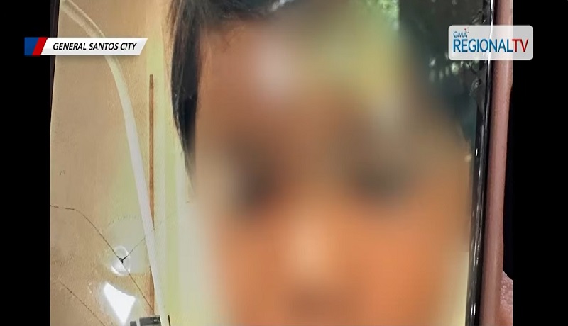 4-anyos na lalaki na nakagat ng asong-gala, nasawi higit 1 buwan kahit naturukan ng kontra-rabies