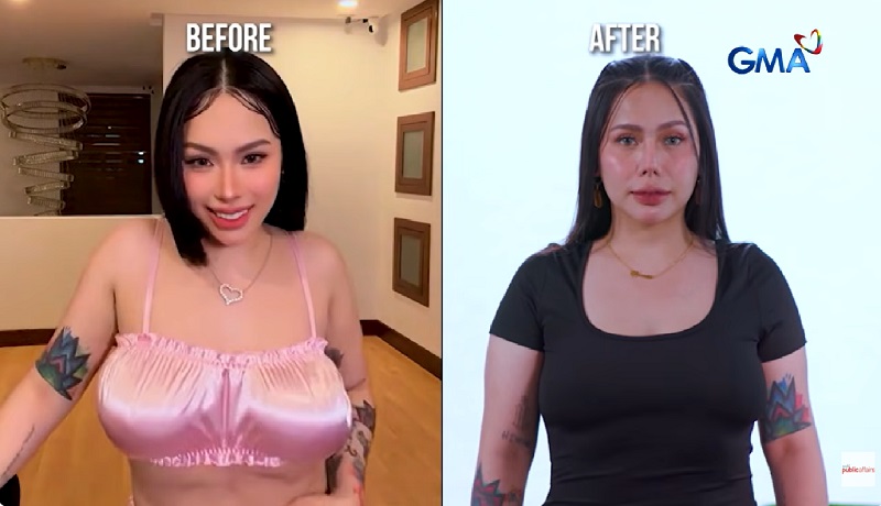 Influencer na si Toni Fowler, bakit piniling ‘paliitin’ ang dibdib?