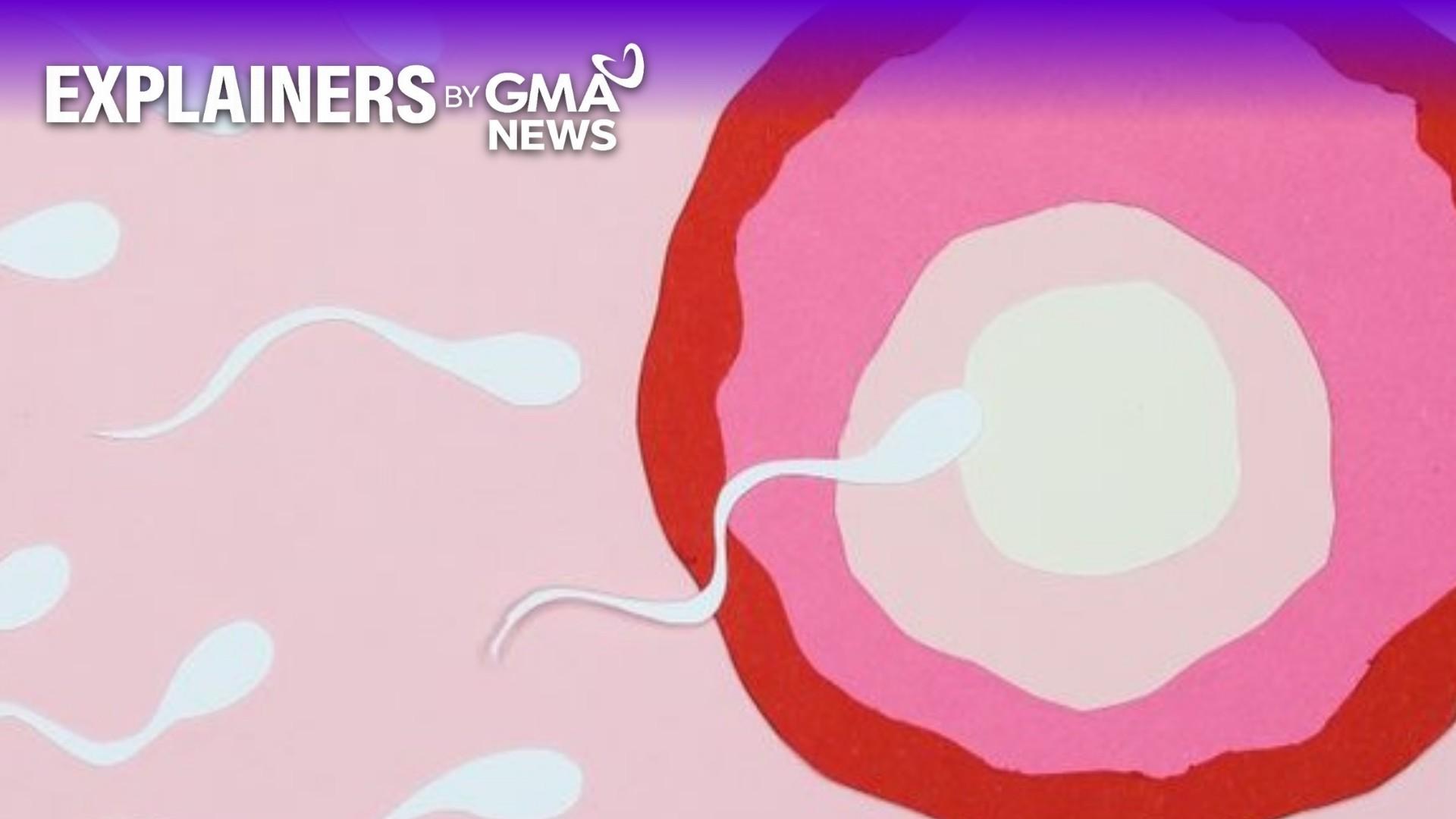 Sperm DNA fragmentation: Why it is now being considered in evaluation, treatment of recurrent miscarriage