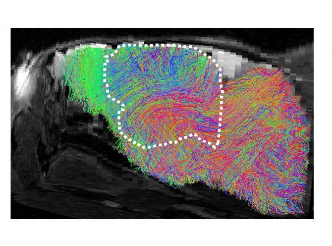 Scientists transplant lab-grown human brain tissue into mice - GMA Network
