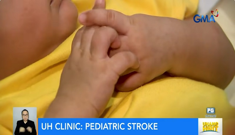 Mga bata, bakit nga ba nagkaka-stroke na rin?; ano ang mga sintomas na dapat bantayan?