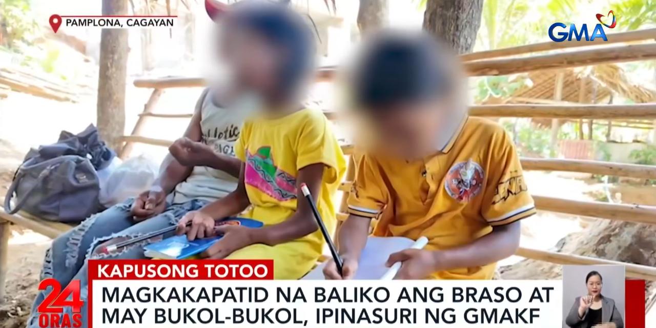 Aeta siblings with rare bone disorder receive aid from GMA Kapuso Foundation Aeta siblings with rare bone disorder receive aid from GMA Kapuso Foundation