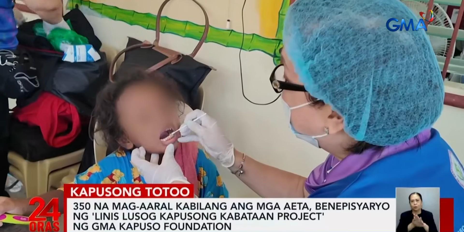 350 students in Zambales receive free dental services, more from GMA Kapuso Foundation
