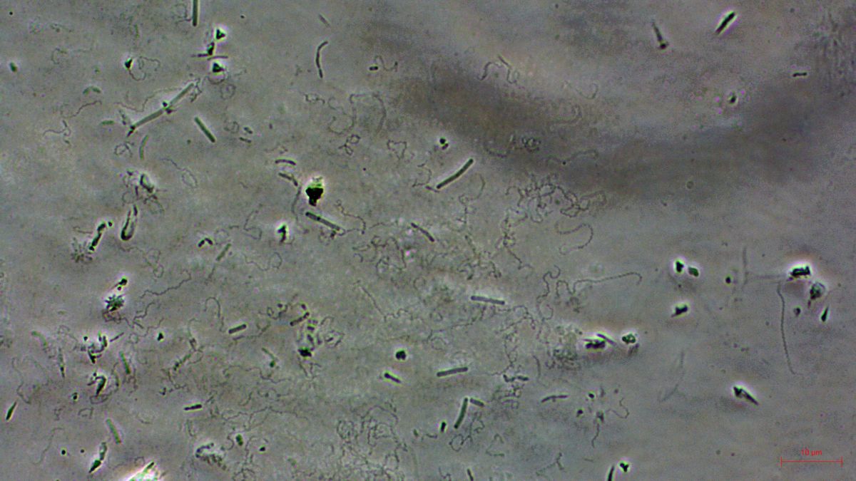 Leptospirosis bacteria found in waterways, soil — UP researchers